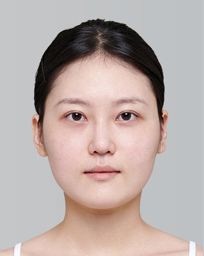 Before Image