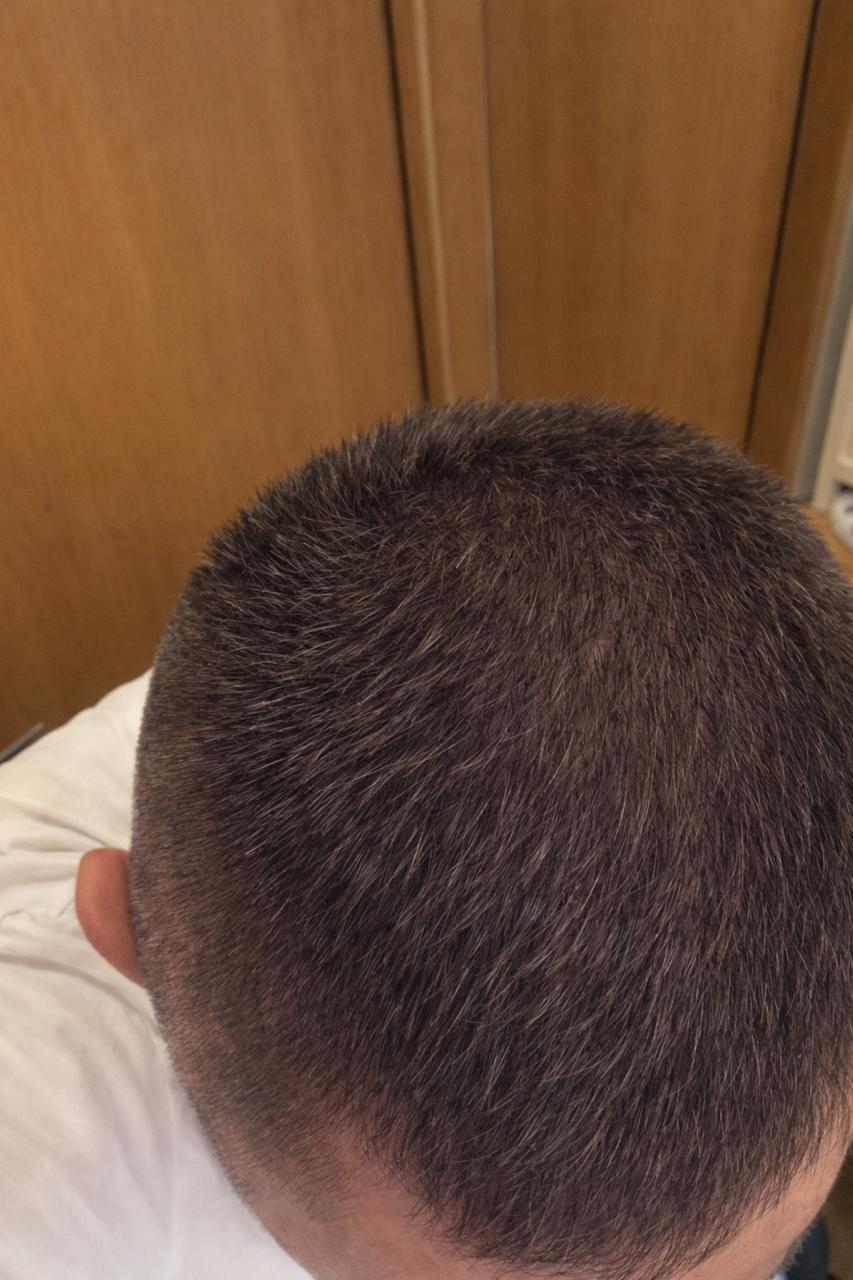 After