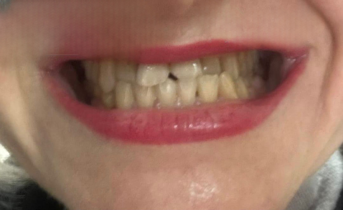 Before